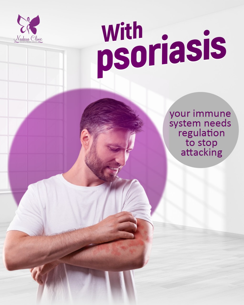 "Psoriasis"